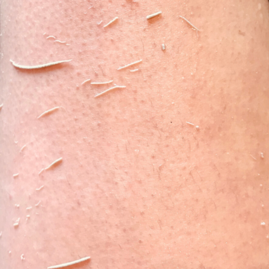 Moroccan Exfoliating Kessa Mitt – Deep Exfoliation